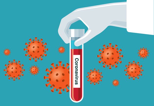Comunidades registram 7 novos casos de coronavírus e mais 2 mortes